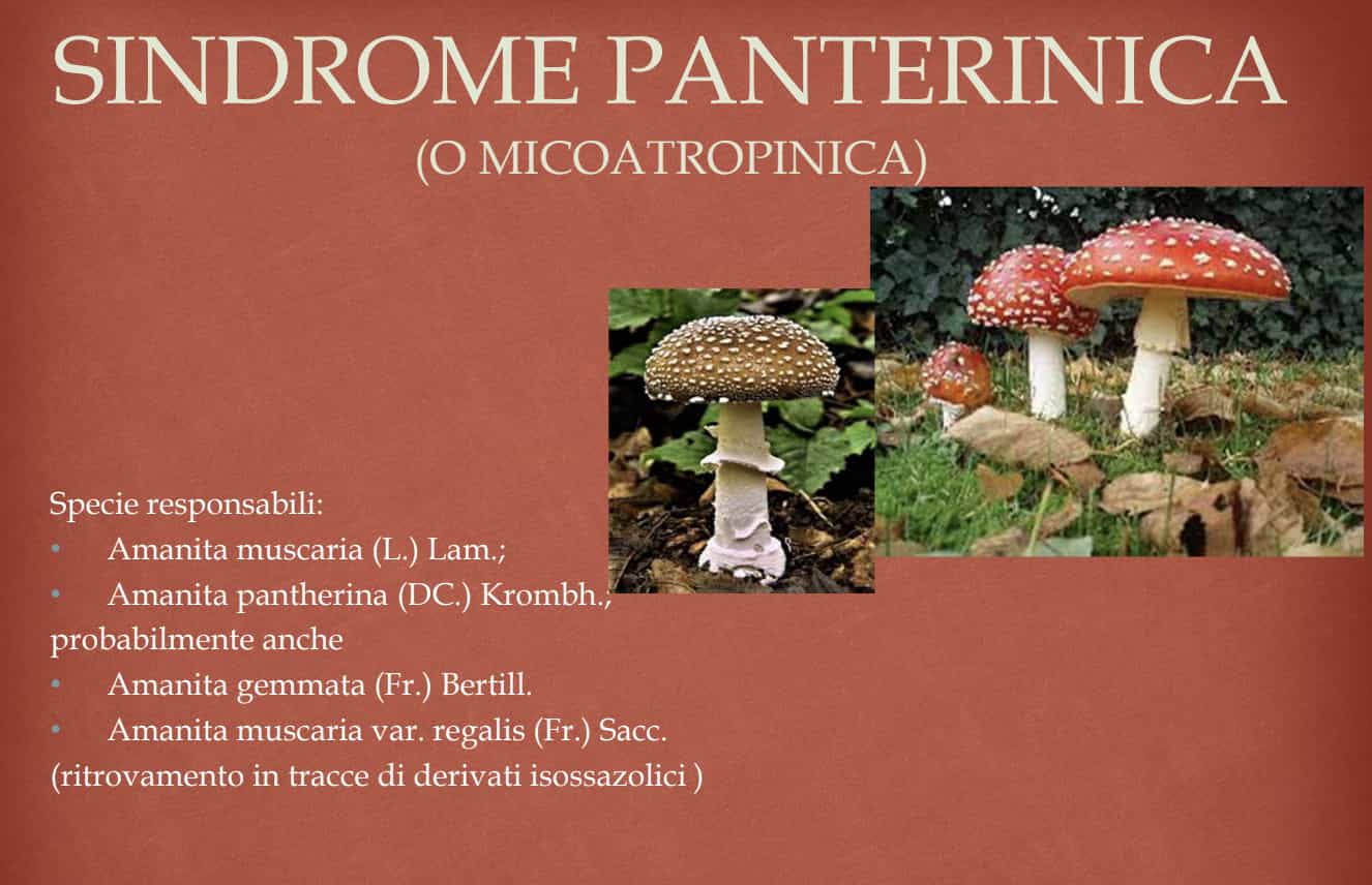 SindromePanterinica